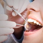 Dental Cleanings and Exams 1 | Houston Uptown Dentists