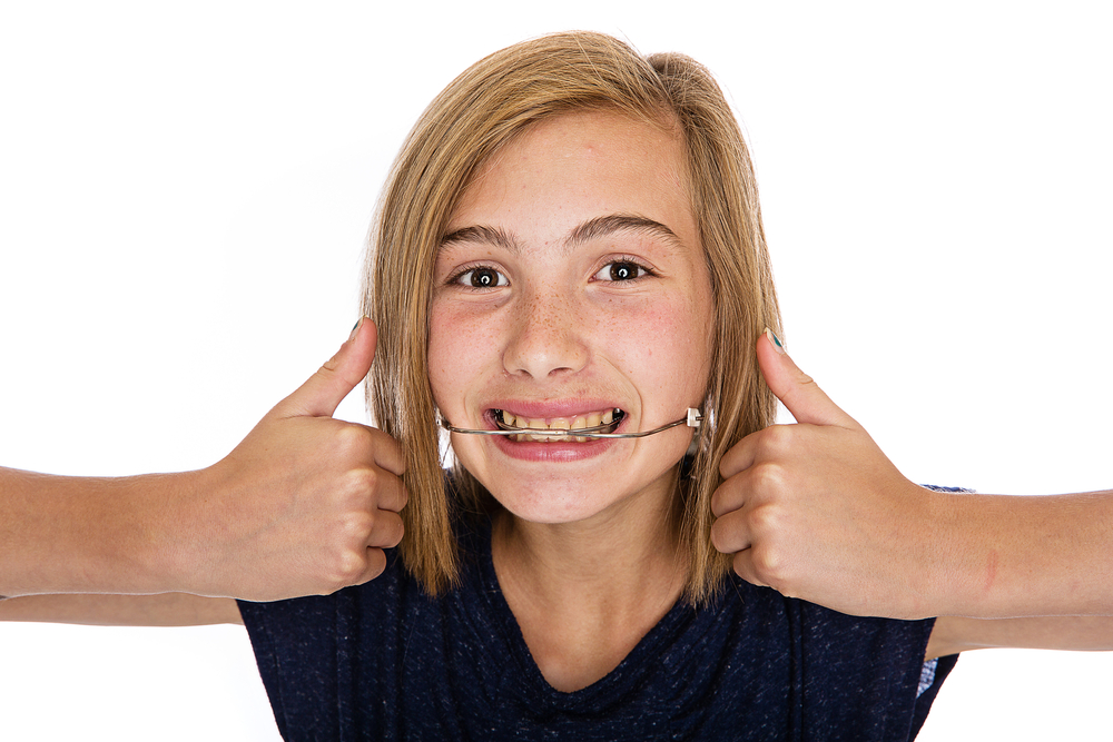 Is Orthodontic Headgear Effective for Teeth Alignment?