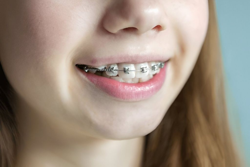 orthodontics near you