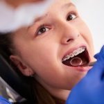 orthodontic treatment with braces